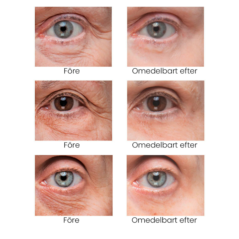 AquaSkin™ – Slätar Ut Påsar, Lyfter Dig